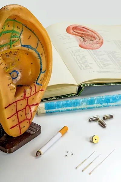 Acupuncture needles, ear model, textbook, moxa cone and herbal pills — Stock Photo, Image