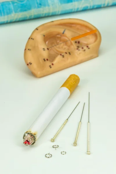 Acupuncture to stop smoking — Stock Photo, Image