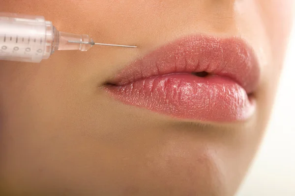 Botox skott i kvinnliga kinden — Stockfoto