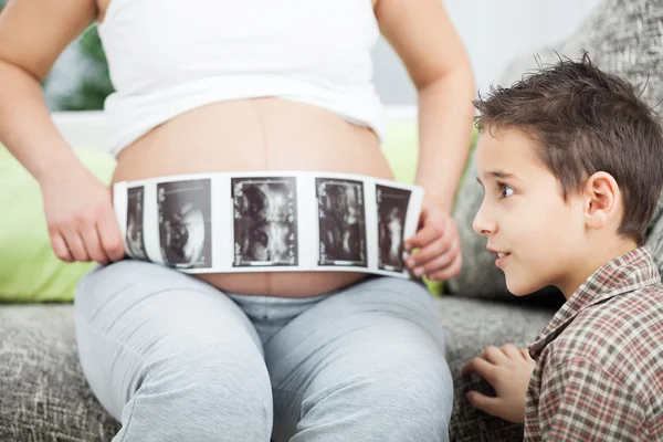 Verbaasd kijkend echografie afbeelding van hun ongeboren brothe jongen — Stockfoto