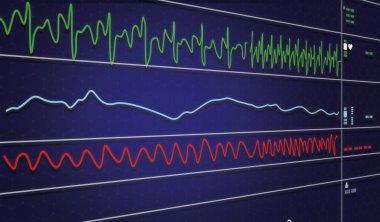 Yoğun bakımda iç aort içi balon pompalama makinesindeki EKG monitörü bulanık arka planda, elektroensefalogramda beyin dalgaları, kalp atış hızı dalgaları