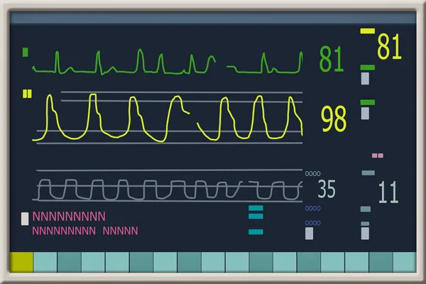 Monitorování Pacientů Vykazuje Známky Ekg Ekg Vektorová Ilustrace — Stock fotografie