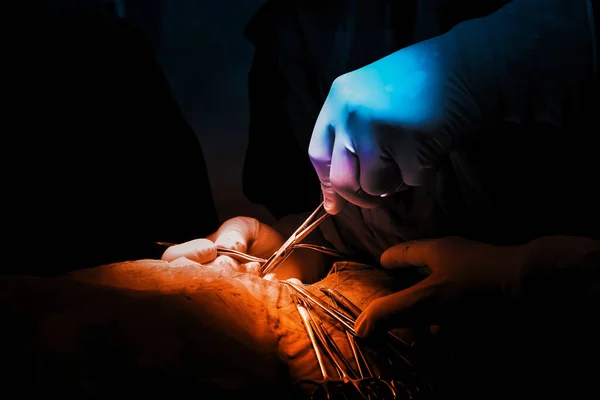 Фотографії Хірургічного Втручання Виконані Спеціалізованим Хірургом Кольорові Тони Розрізняють Синій — стокове фото