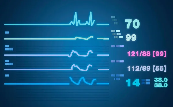 Beteg Monitoron Életjelek Ekg Ekg Vektorillusztráció — Stock Fotó