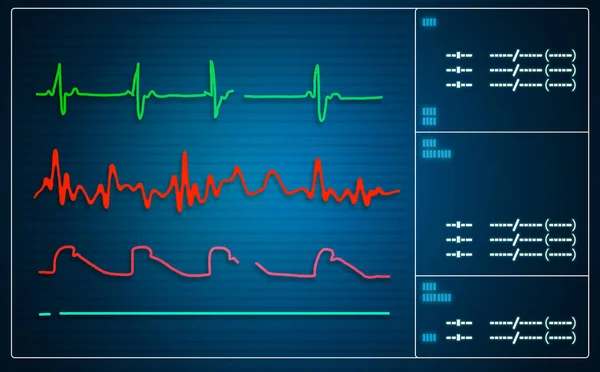 重要な徴候を示す患者モニタ Ecg Ekg — ストック写真