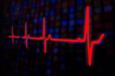 Hasta monitörü EKG ve EKG 'de hayati göstergeler gösteriyor.. 