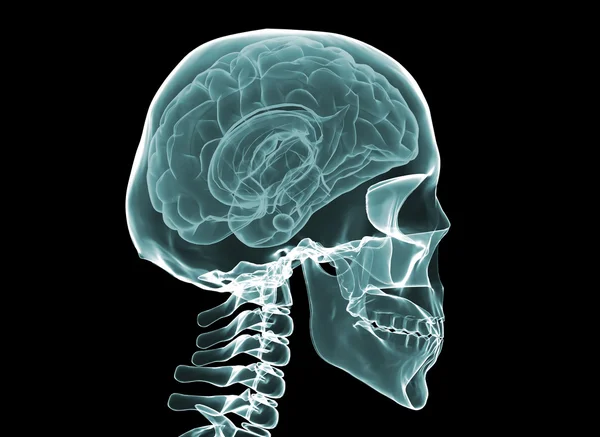X-ray hersenen en skelet — Stockfoto