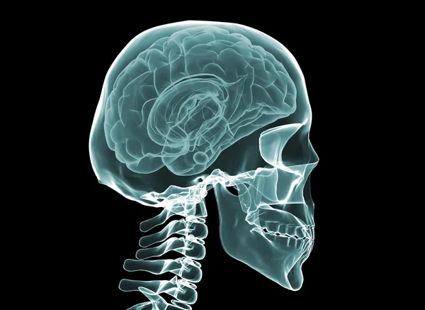 X 射线的大脑和骨骼 — 图库照片
