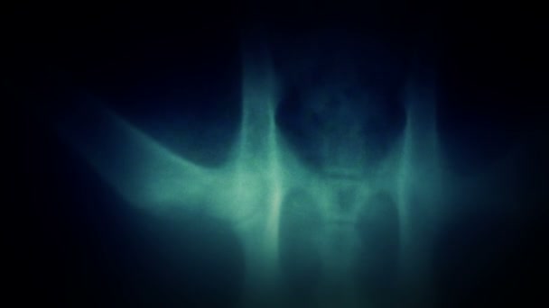Raggi X. Scansione radiografica umana — Video Stock