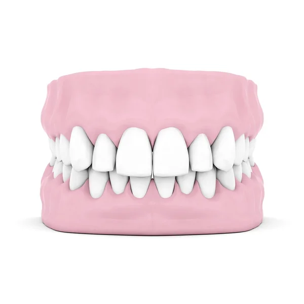 Dentures — Stock Photo, Image