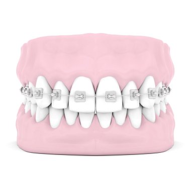 Diş ParçalarıComment