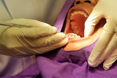 diş hekimi Ortodonti