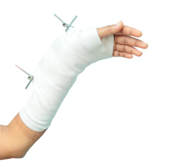 Stainless Arm Brace — Stock Photo, Image