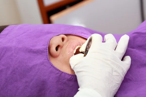 Dentist Teeth Printing — Stock Photo, Image