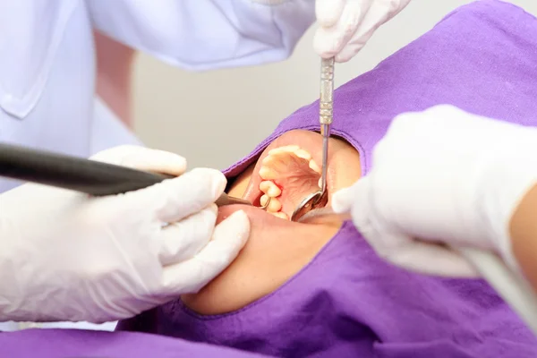 Mouth Examining — Stock Photo, Image