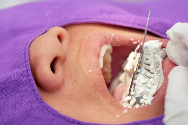 Zahnarztzähne drucken — Stockfoto