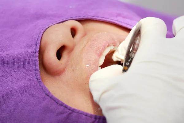 Dentist Teeth Printing — Stock Photo, Image