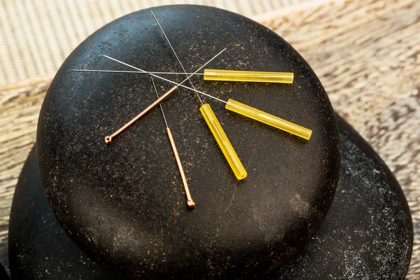 Agujas de acupuntura — Foto de Stock
