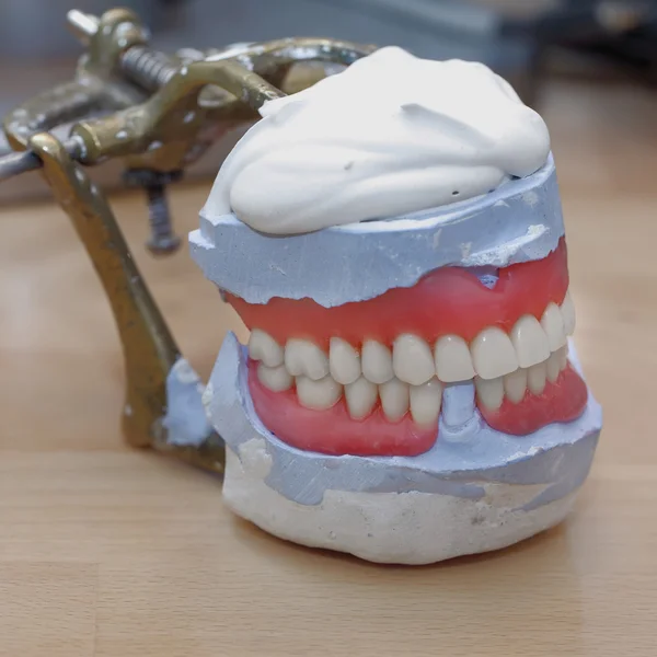 Diş laboratuarı articulator — Stok fotoğraf