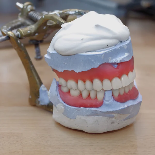 Dental lab uppmärksam — Stockfoto