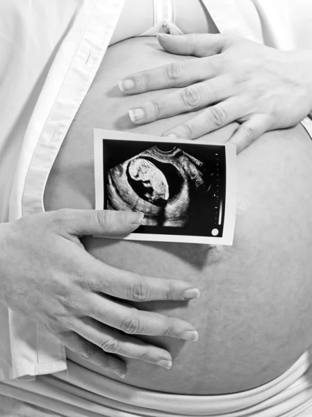 Ultrasound in hands — Stock Photo, Image