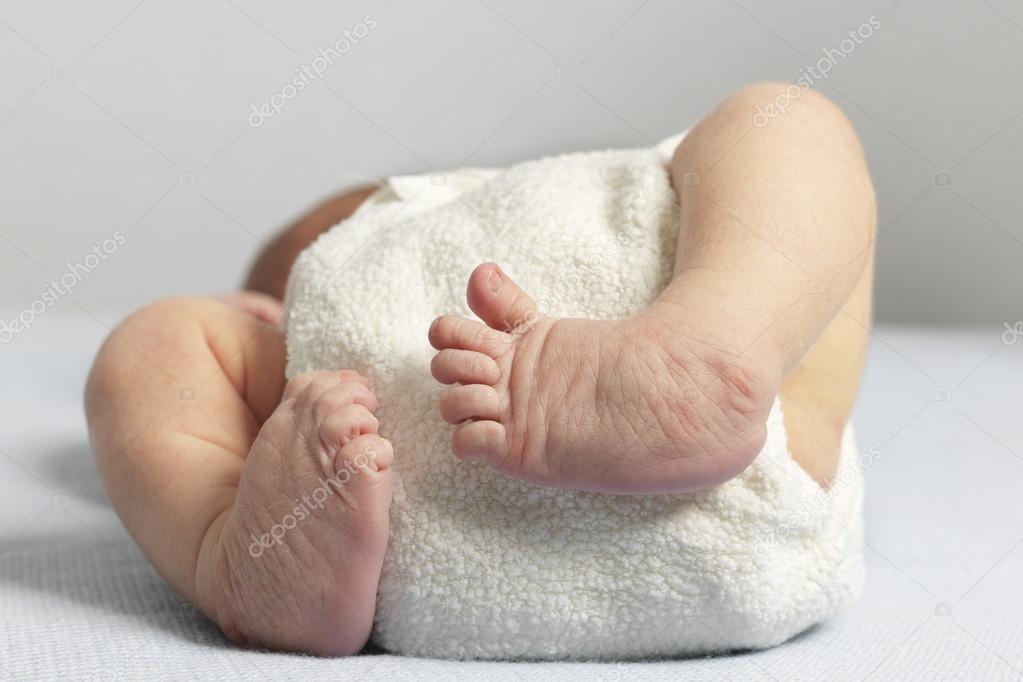 Newborn With Bilateral Club Foot Stock Photo By C Aglphotoproduction