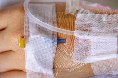 Woman's hand piercing needle to give saline solution