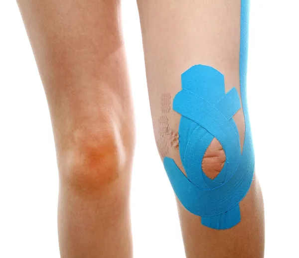 Therapeutische Behandlung des Beines mit blauem Physiotape — Stockfoto