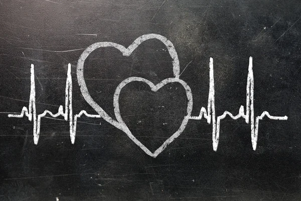 Caractère et design de Heartbeat — Photo