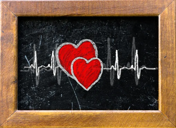Αγάπη καρδιά σε μια chalkboard — Φωτογραφία Αρχείου