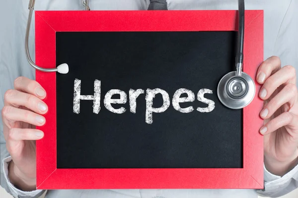 Herpes — Fotografia de Stock