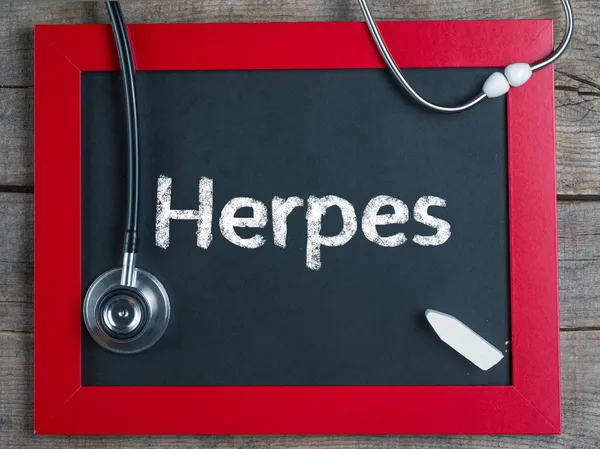 Herpes — Fotografia de Stock