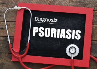 Tebeşir tahtasında steteskopun yanında PSORIASIS kelimesi. Tıbbi konsept