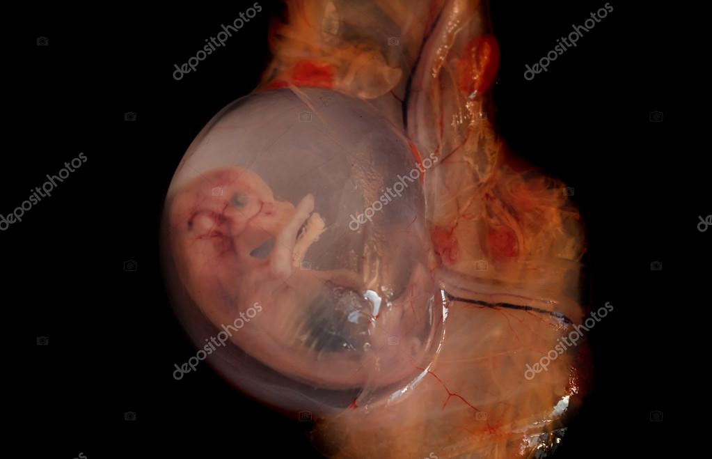 Embriões abortados — Fotografia de Stock
