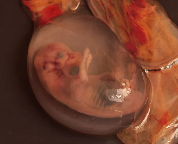 Aborted embryo — Stock Photo, Image