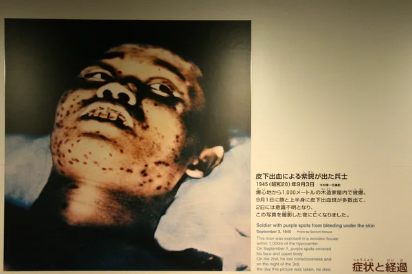 Memorial da Paz, Hiroshima, Japão — Fotografia de Stock