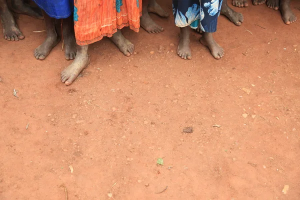 Pés das crianças africanas — Fotografia de Stock