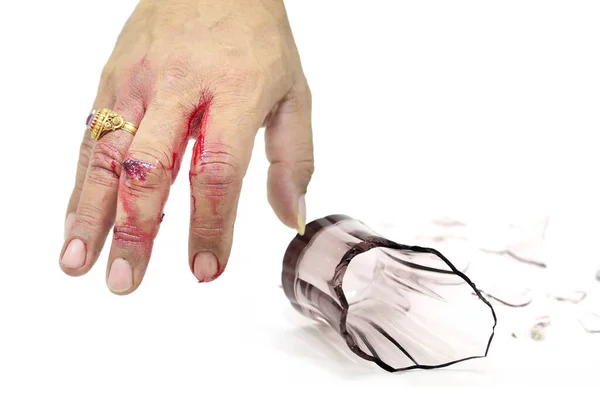 Zbliżenie Dłoń Kontuzja Nożem Szkło Ostre Przedmioty Prawdziwa Krwawa Ręka — Zdjęcie stockowe