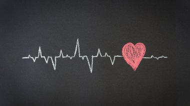 Heartbeat Diagram