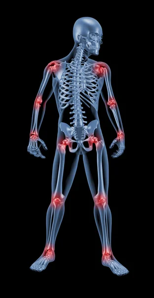 Skeleton with joins highlighted — Stock Photo, Image