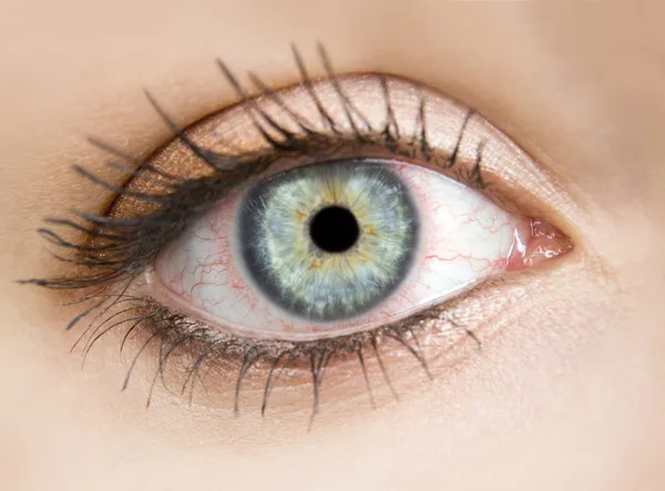 Red eyes — Stock Photo, Image