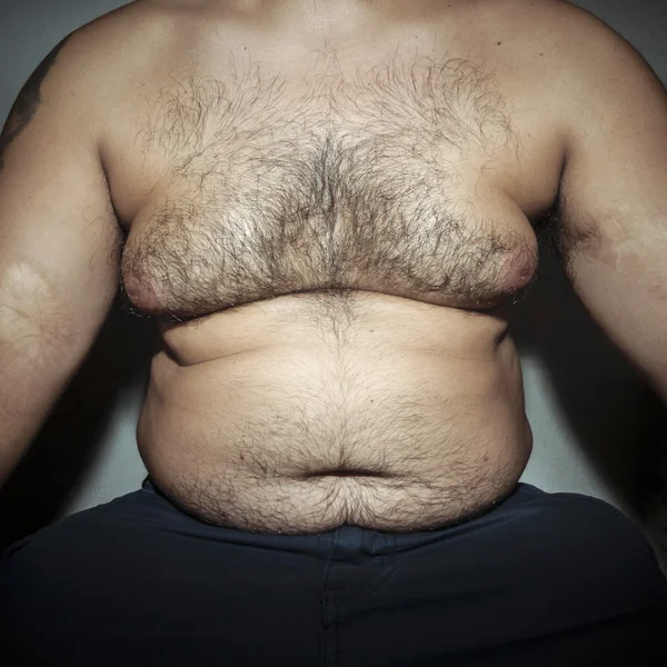 Magen fett och hårig man — Stockfoto