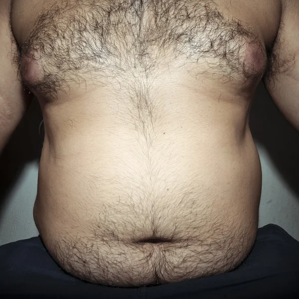 Magen fett och hårig man — Stockfoto