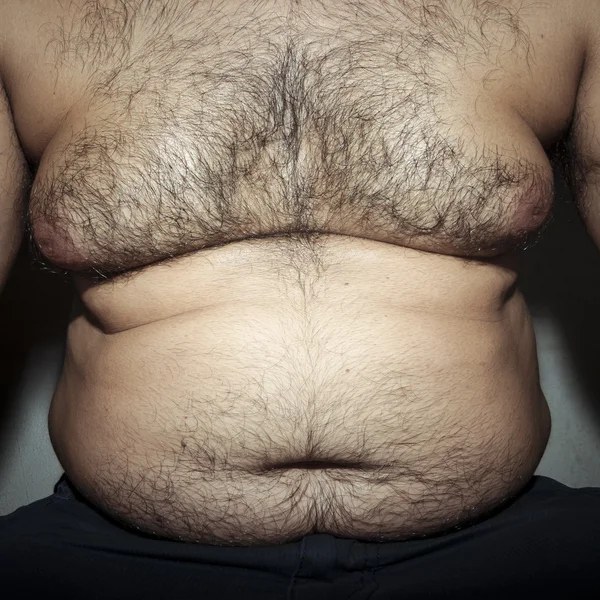 Belly fat and hairy man — Stock Photo, Image