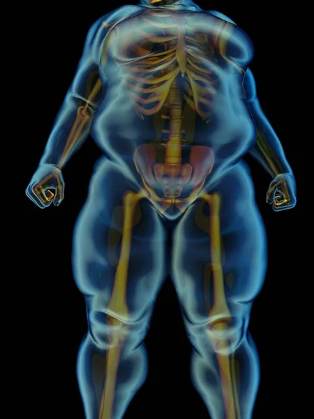 뚱뚱한 남자의 엑스레이 렌더링 — 스톡 사진