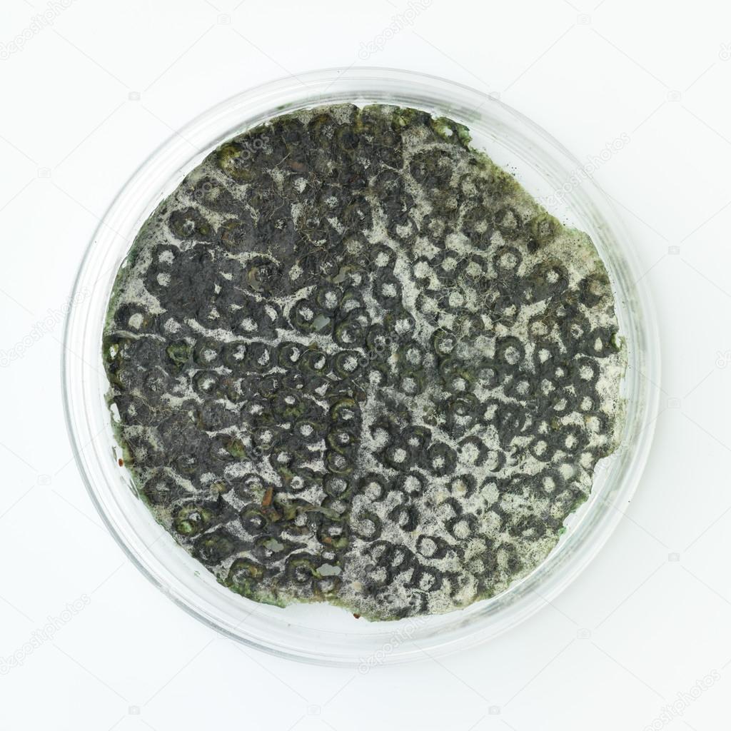 Green mold in a petri dish — Stock Photo © shotsstudio 27703655