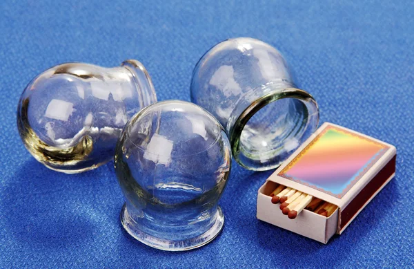 Cupping glass. — Stock Image Cupping glass. Stock Picture