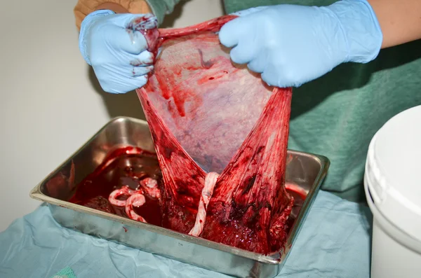 Kifeszített nyitott emberi placenta megtekintése — Stock Fotó