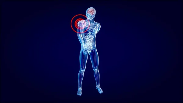 Анатомическая Концепция Боли Плече — стоковое фото
