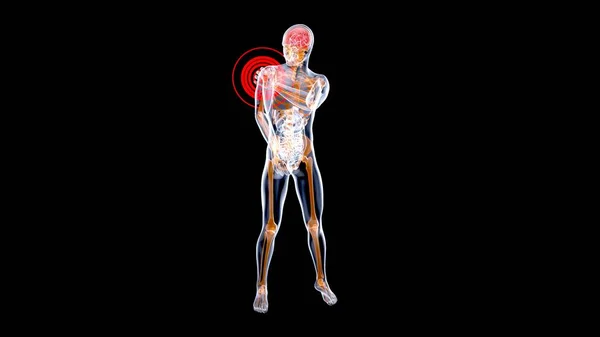 肩痛的解剖学概念 — 图库照片